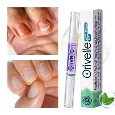 what is Orivelle Anti-Fungal Pen